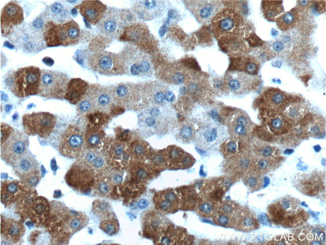 PCBP2 Antibody in Immunohistochemistry (Paraffin) (IHC (P))