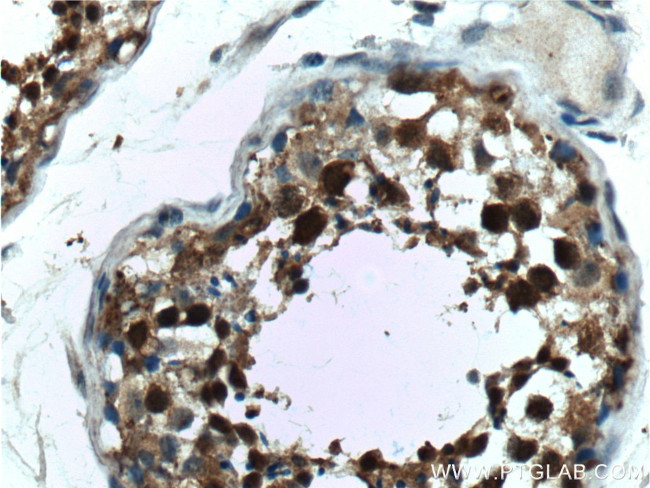 PCBP2 Antibody in Immunohistochemistry (Paraffin) (IHC (P))