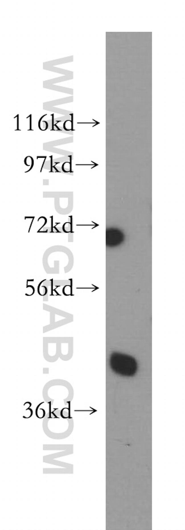 PCBP2 Antibody in Western Blot (WB)