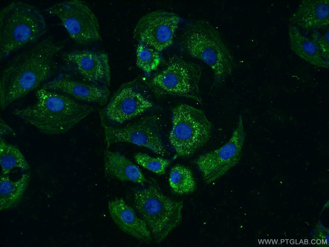 TTBK2 Antibody in Immunocytochemistry (ICC/IF)