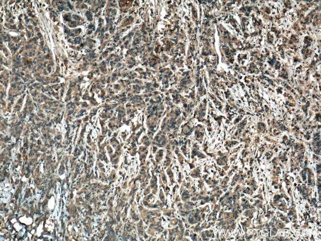 TTBK2 Antibody in Immunohistochemistry (Paraffin) (IHC (P))