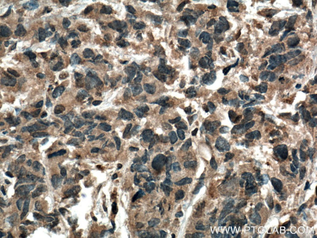 TTBK2 Antibody in Immunohistochemistry (Paraffin) (IHC (P))