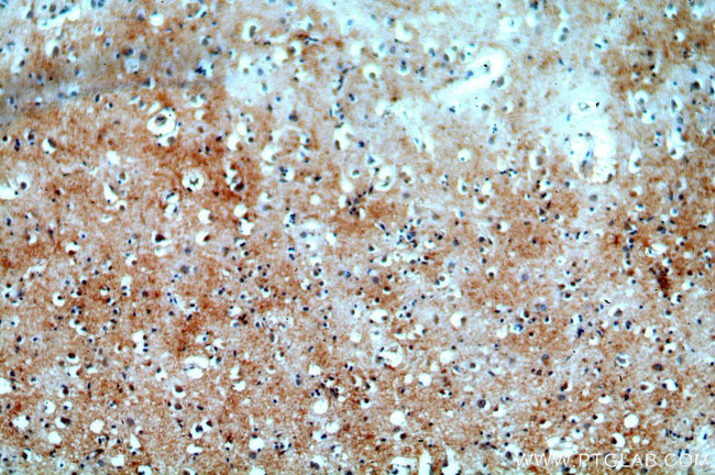 TTBK2 Antibody in Immunohistochemistry (Paraffin) (IHC (P))