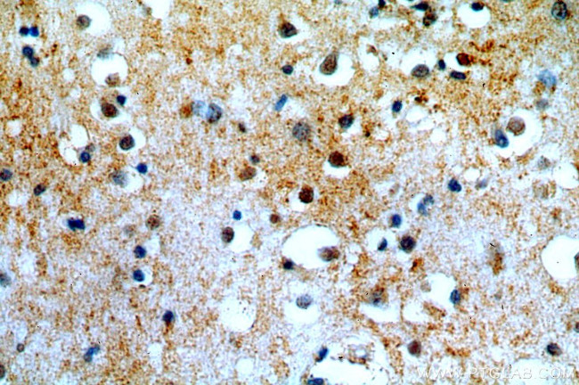 TTBK2 Antibody in Immunohistochemistry (Paraffin) (IHC (P))