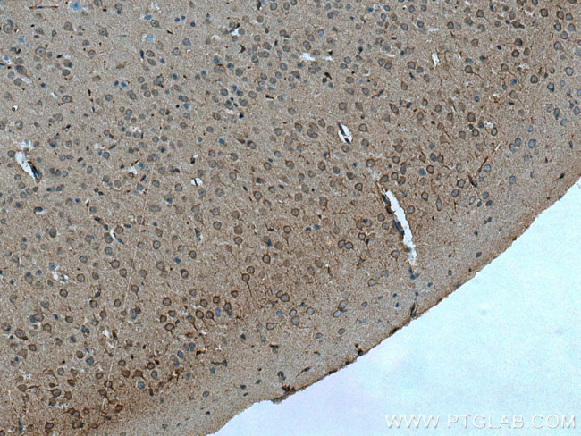 TTBK2 Antibody in Immunohistochemistry (Paraffin) (IHC (P))