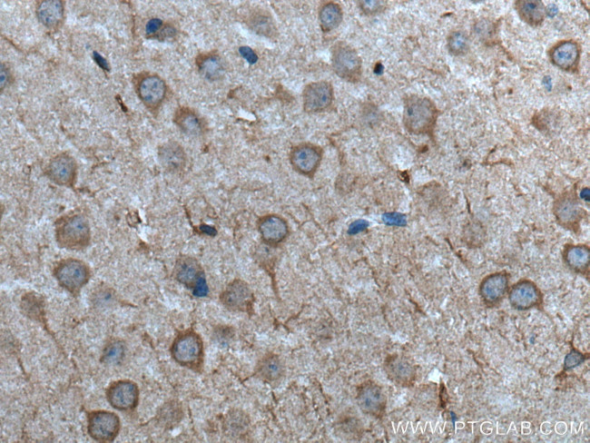 TTBK2 Antibody in Immunohistochemistry (Paraffin) (IHC (P))