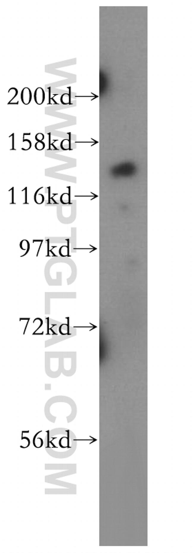 TTBK2 Antibody in Western Blot (WB)