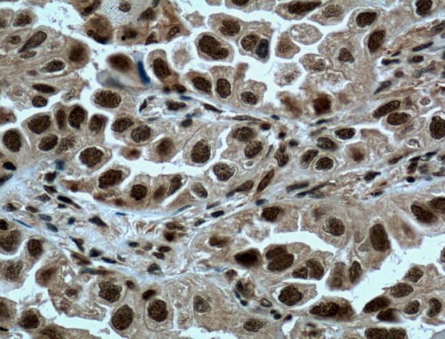 METTL3 Antibody in Immunohistochemistry (Paraffin) (IHC (P))