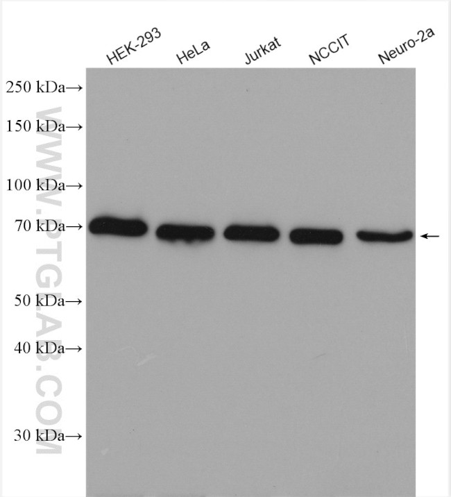 METTL3 Antibody in Western Blot (WB)