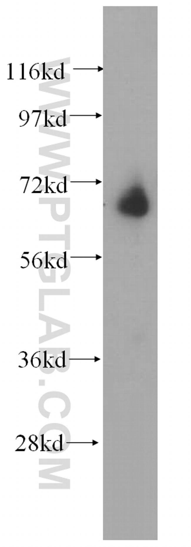 METTL3 Antibody in Western Blot (WB)