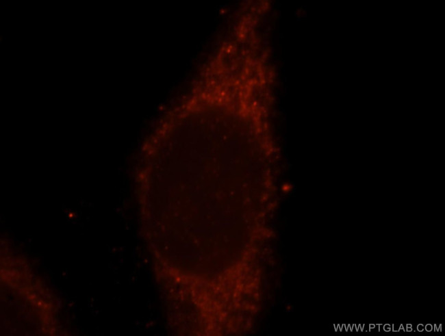 SUOX Antibody in Immunocytochemistry (ICC/IF)