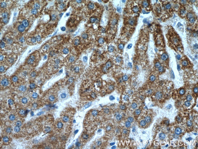 SUOX Antibody in Immunohistochemistry (Paraffin) (IHC (P))