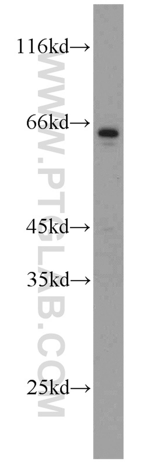 SUOX Antibody in Western Blot (WB)