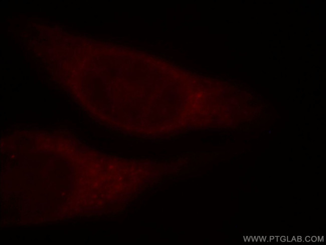 VPS8 Antibody in Immunocytochemistry (ICC/IF)