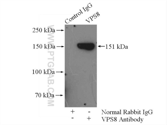 VPS8 Antibody in Immunoprecipitation (IP)