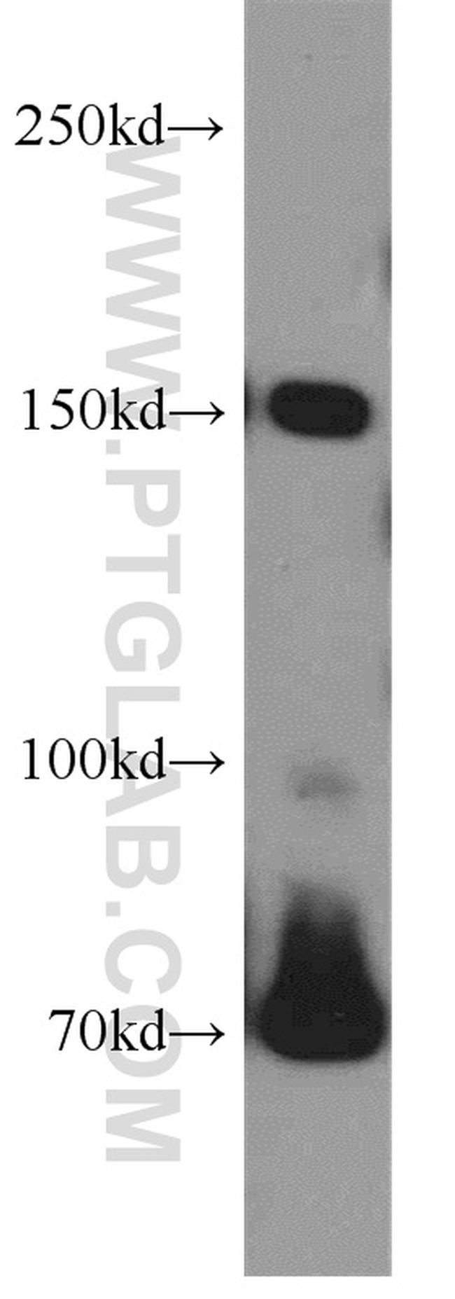 VPS8 Antibody in Western Blot (WB)