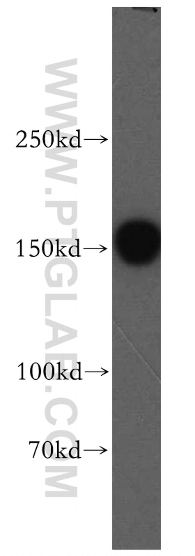 VPS8 Antibody in Western Blot (WB)