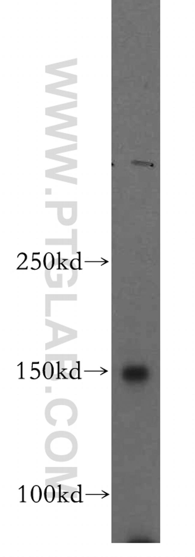 VPS8 Antibody in Western Blot (WB)