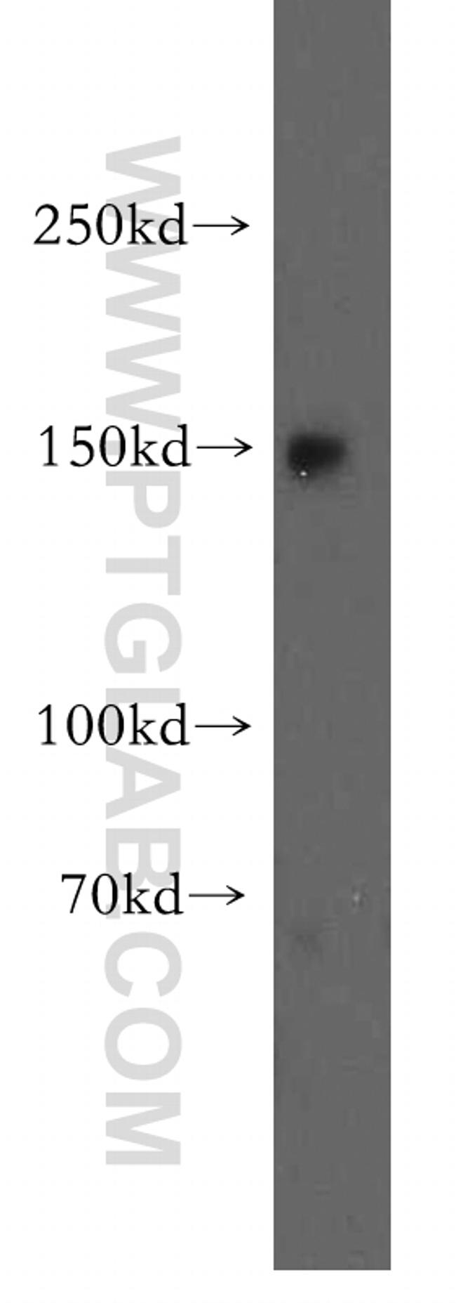 VPS8 Antibody in Western Blot (WB)