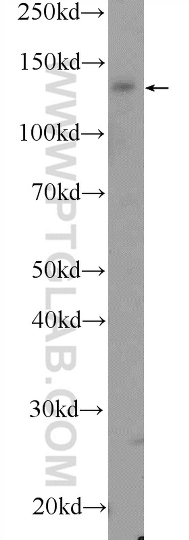 VPS8 Antibody in Western Blot (WB)