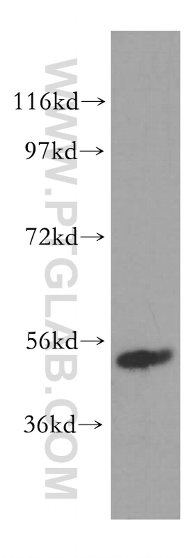 LPCAT2 Antibody in Western Blot (WB)