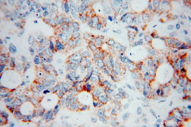 COQ7 Antibody in Immunohistochemistry (Paraffin) (IHC (P))