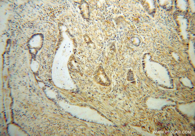 RPS19 Antibody in Immunohistochemistry (Paraffin) (IHC (P))