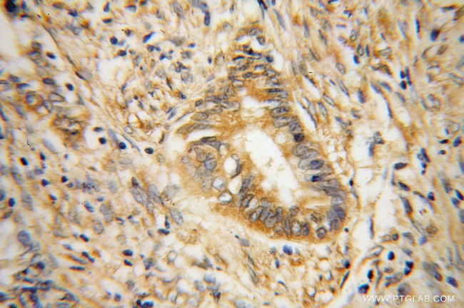 RPS19 Antibody in Immunohistochemistry (Paraffin) (IHC (P))