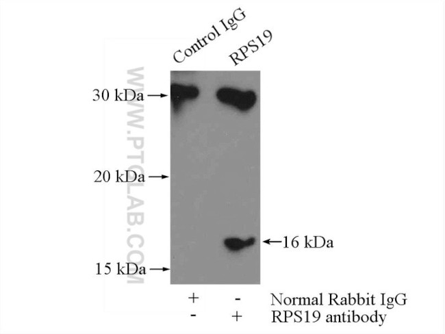 RPS19 Antibody in Immunoprecipitation (IP)