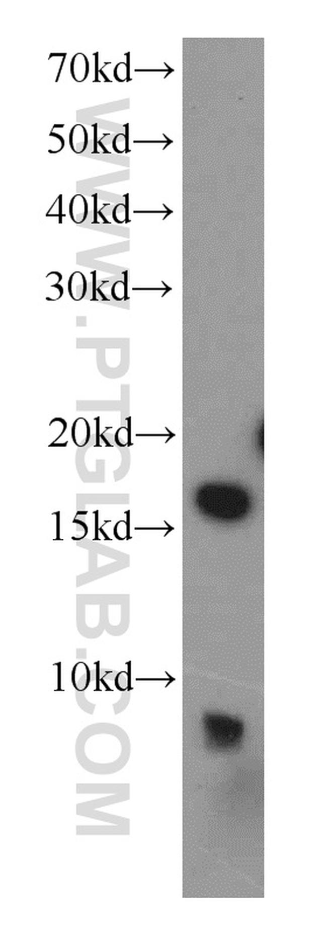 RPS19 Antibody in Western Blot (WB)