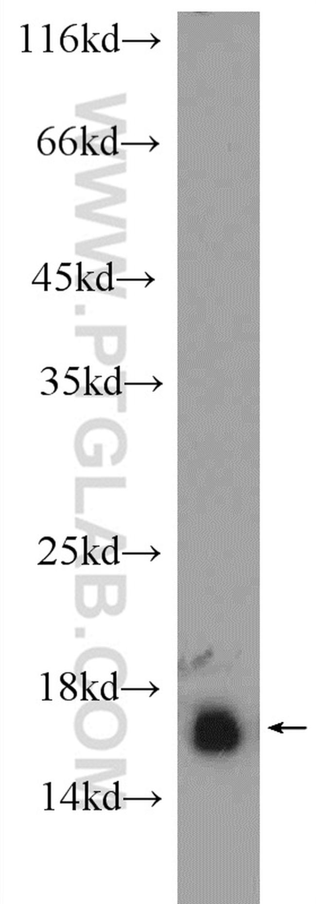 RPS19 Antibody in Western Blot (WB)