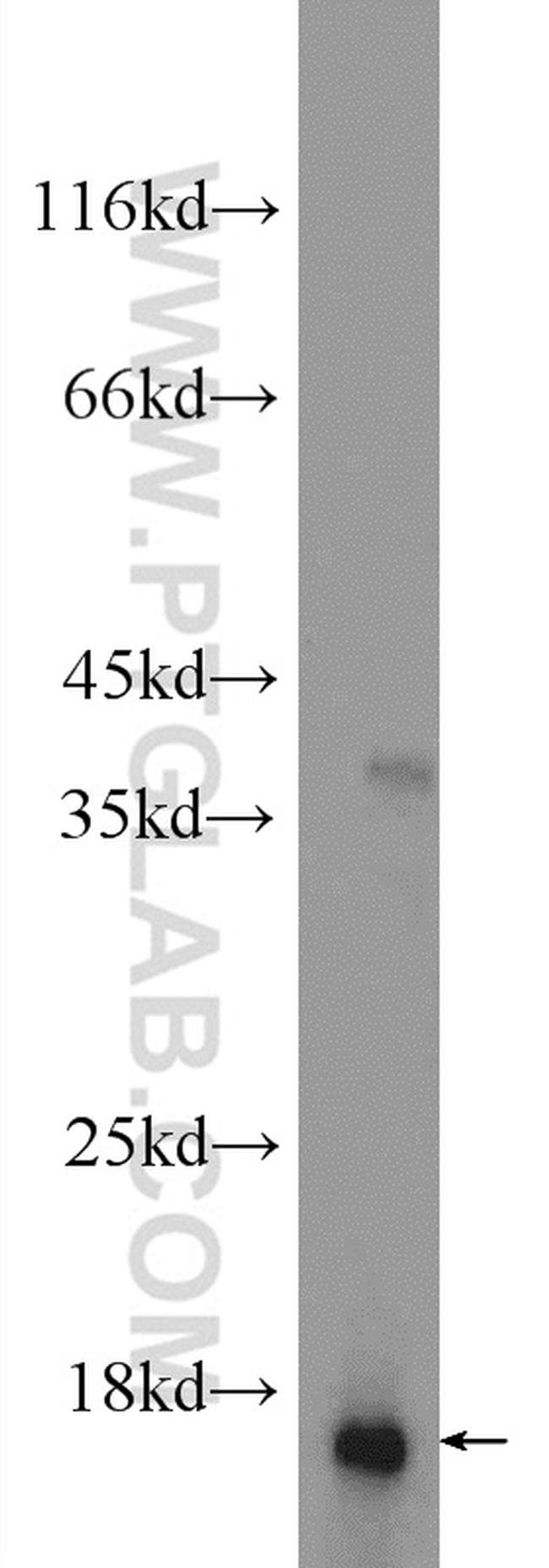 RPS19 Antibody in Western Blot (WB)