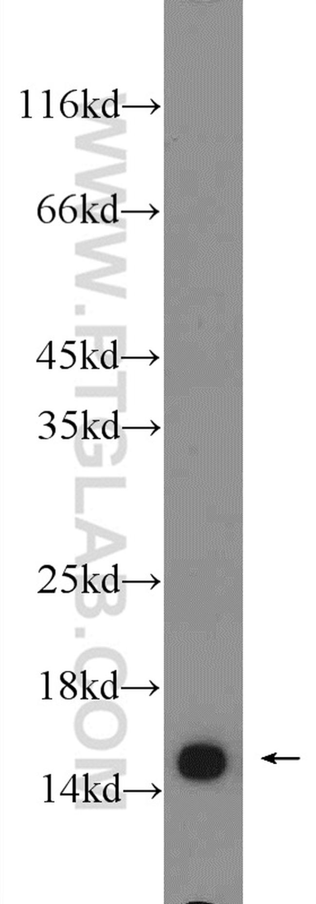 RPS19 Antibody in Western Blot (WB)