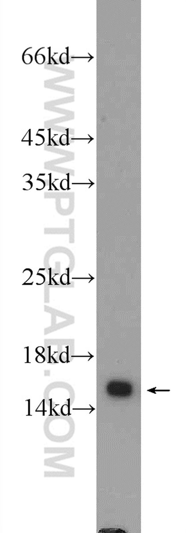 RPS19 Antibody in Western Blot (WB)