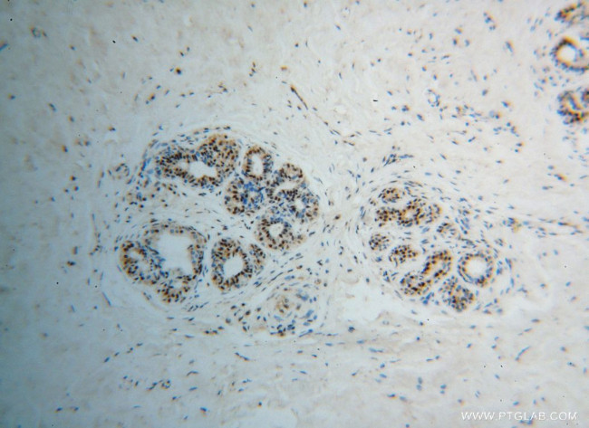 POLR2H Antibody in Immunohistochemistry (Paraffin) (IHC (P))