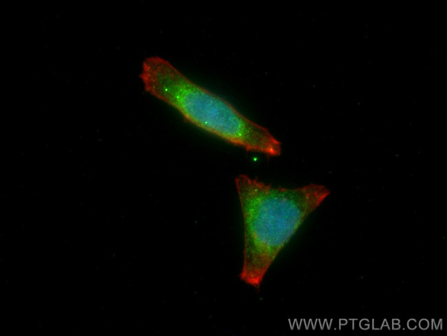 SEC61B Antibody in Immunocytochemistry (ICC/IF)