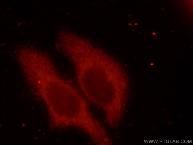 SEC61B Antibody in Immunocytochemistry (ICC/IF)