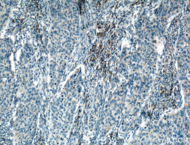 SEC61B Antibody in Immunohistochemistry (Paraffin) (IHC (P))