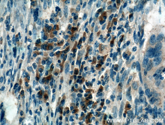 SEC61B Antibody in Immunohistochemistry (Paraffin) (IHC (P))