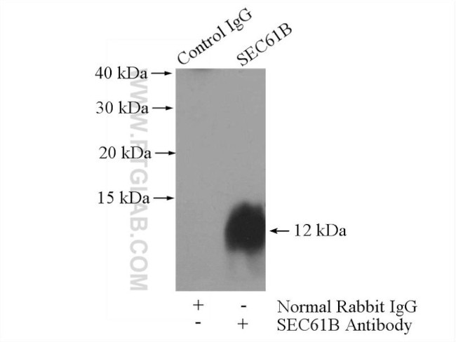 SEC61B Antibody in Immunoprecipitation (IP)