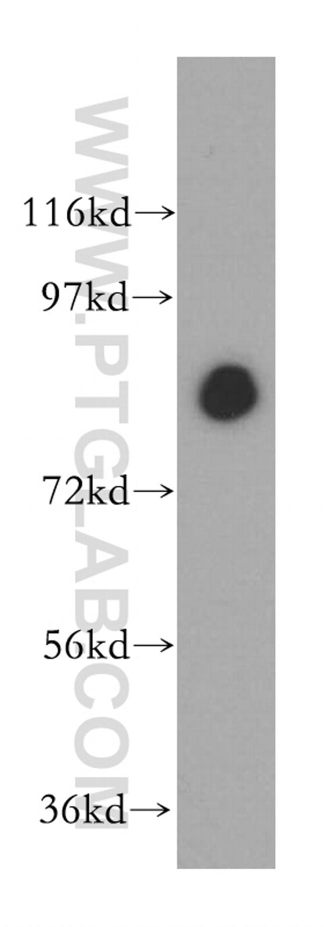 ANTXR1 Antibody in Western Blot (WB)