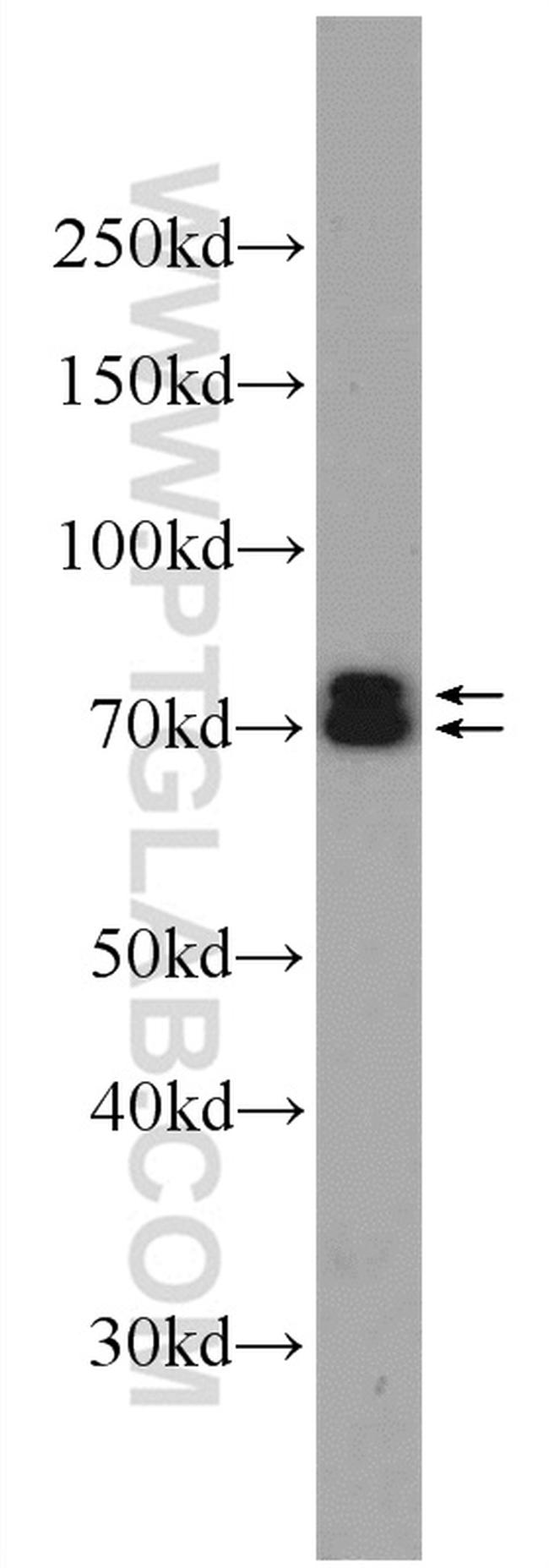 ANTXR1 Antibody in Western Blot (WB)