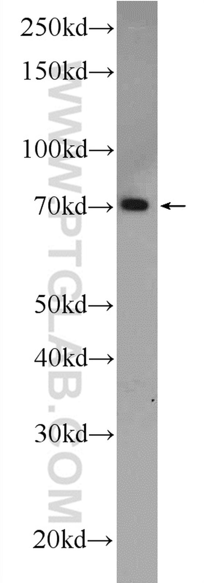 ANTXR1 Antibody in Western Blot (WB)