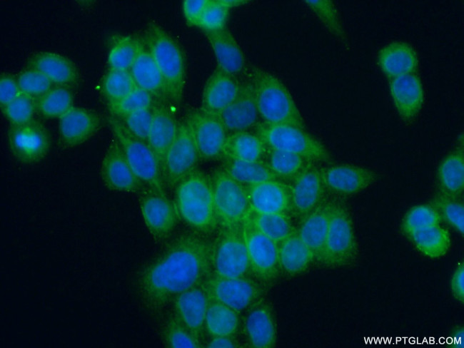 ANTXR1 Antibody in Immunocytochemistry (ICC/IF)