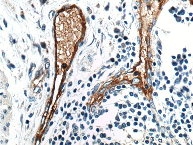 ANTXR1 Antibody in Immunohistochemistry (Paraffin) (IHC (P))