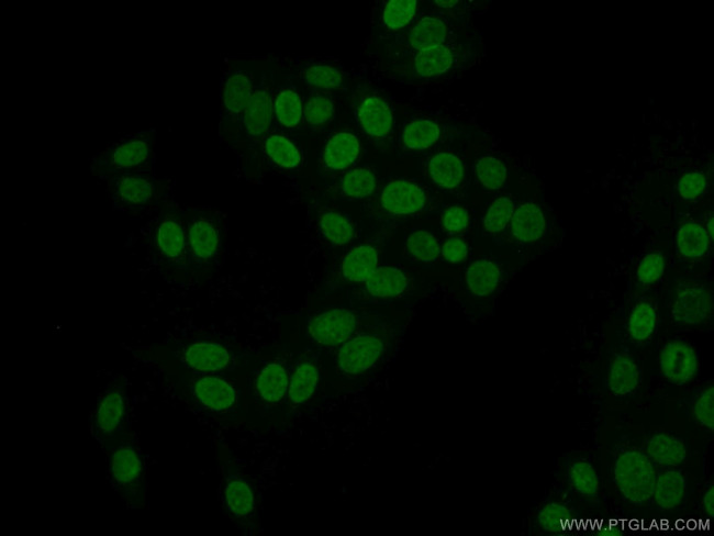 SCML1 Antibody in Immunocytochemistry (ICC/IF)