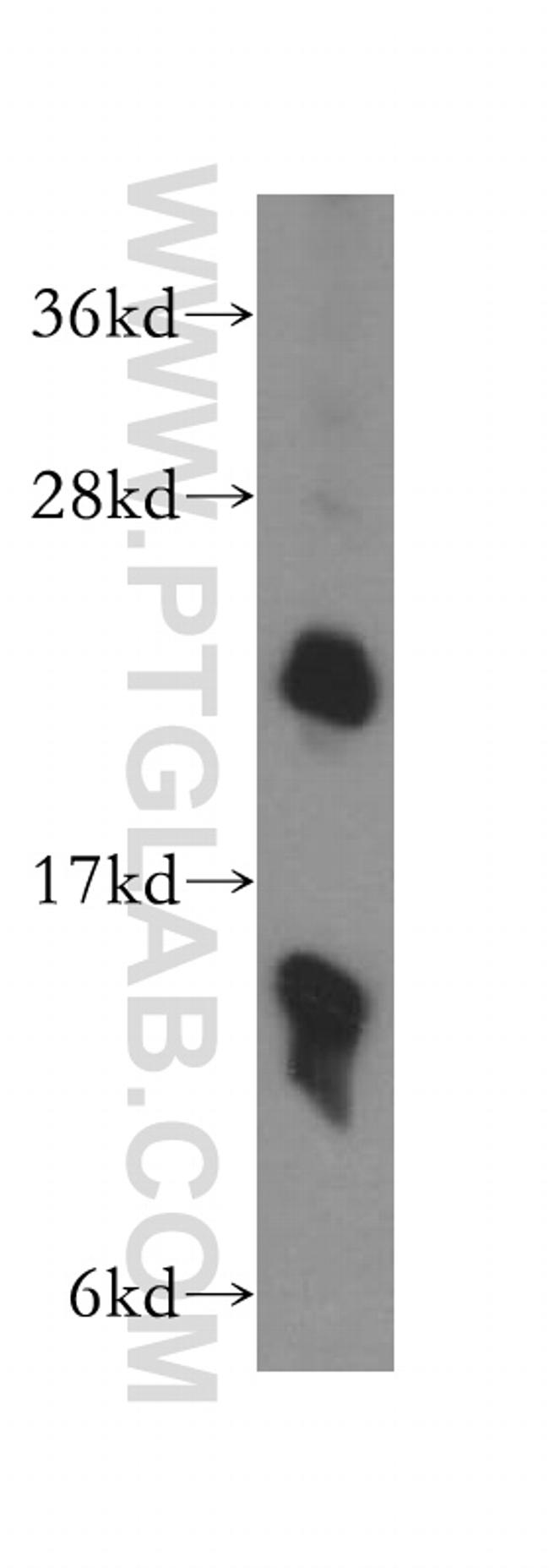 SCML1 Antibody in Western Blot (WB)