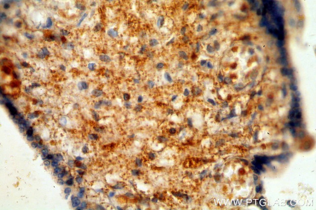 NAGA Antibody in Immunohistochemistry (Paraffin) (IHC (P))