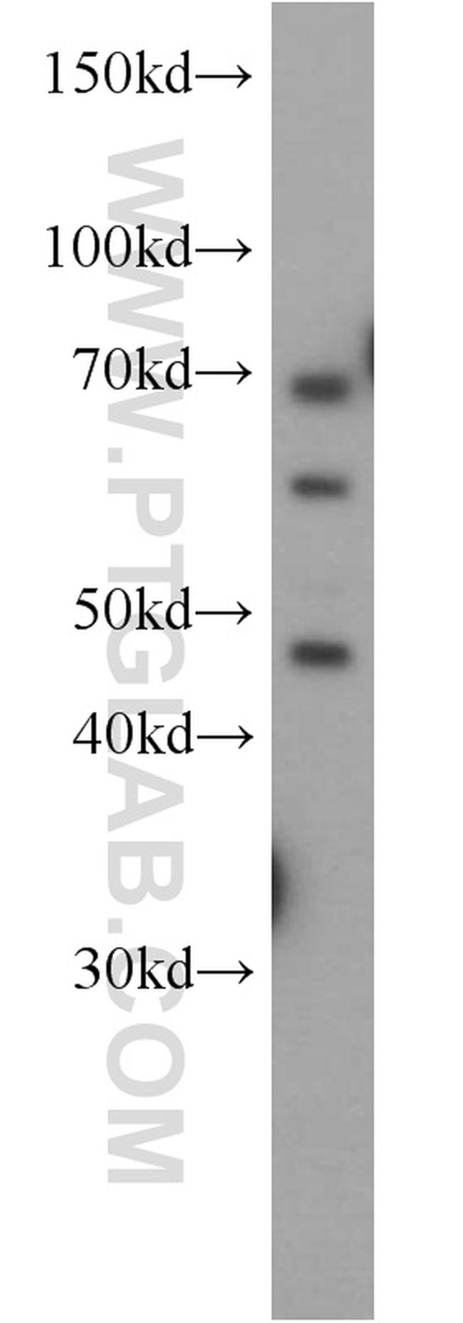 NAGA Antibody in Western Blot (WB)