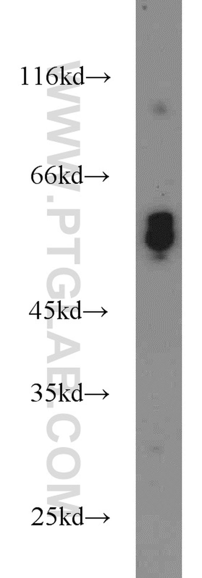 ATP6V1B2 Antibody in Western Blot (WB)